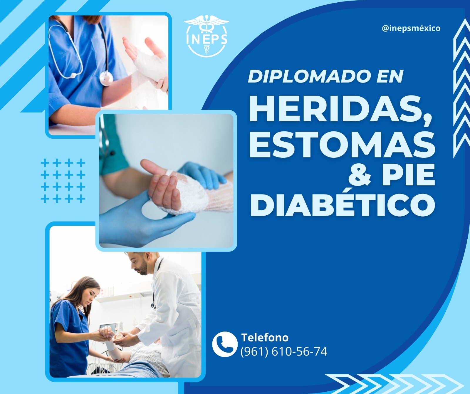HERIDAS, ESTOMAS Y PIE DIABÉTICO